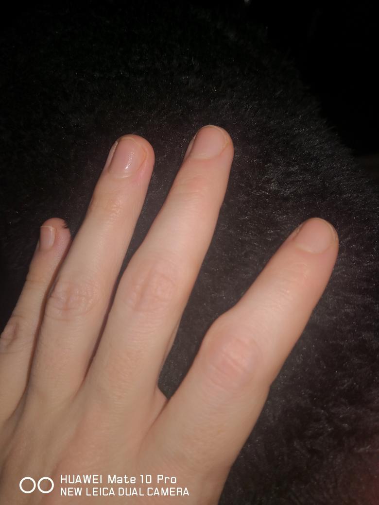 Finger und Fußnagel