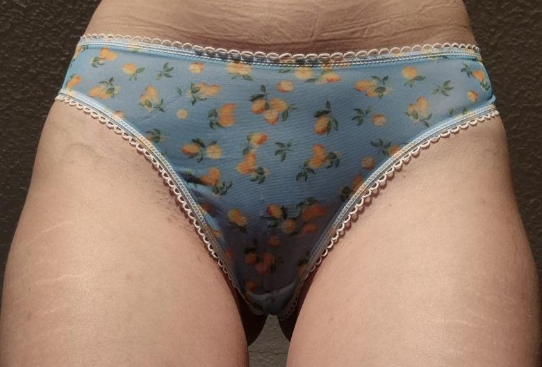 🍋💙Blue Lemon Slip💙🍋