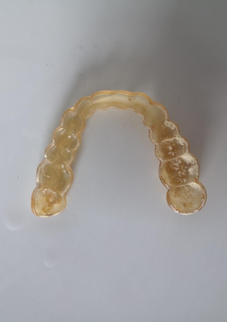 2 Jahre benutze Knirschschiene