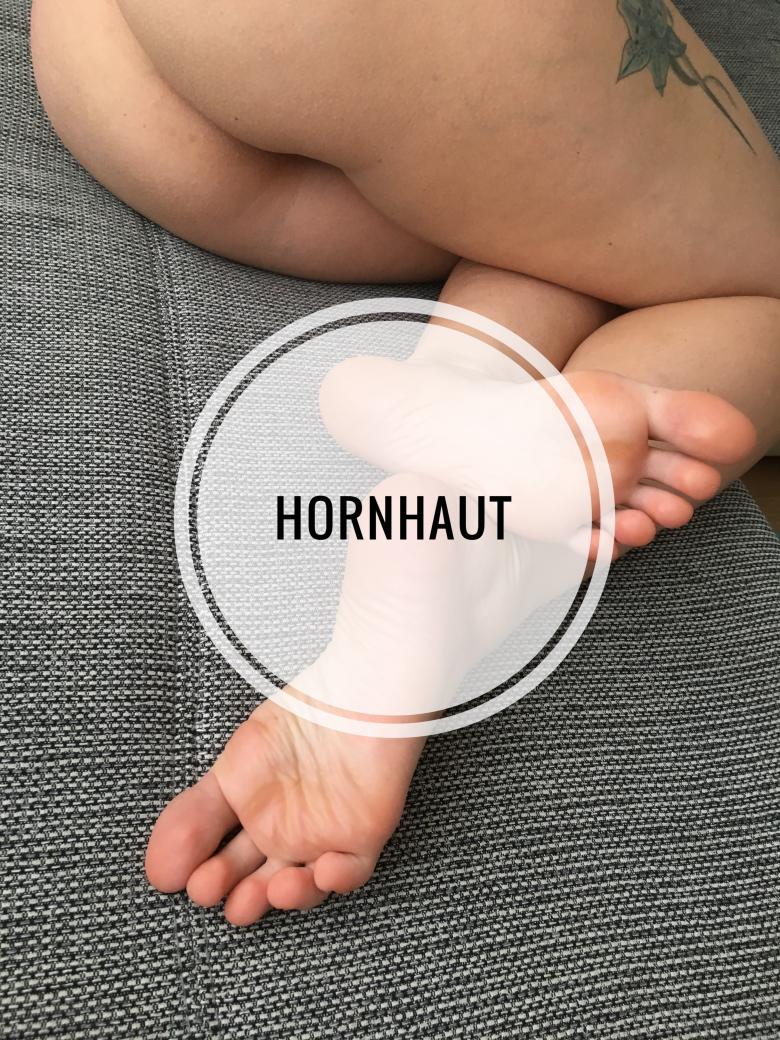 Hornhaut