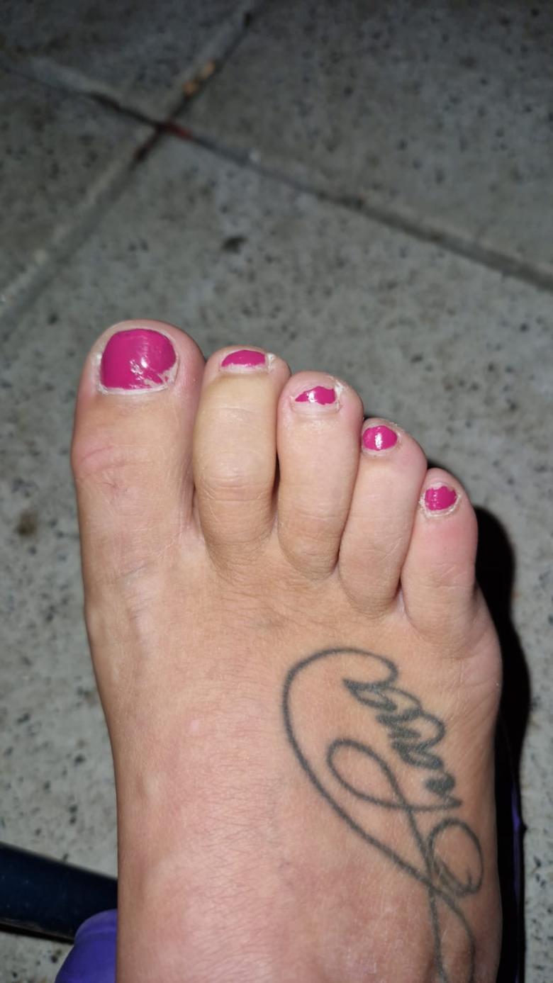 lackierte Fußnägel