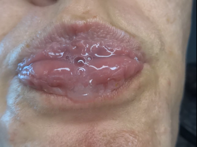 mein geiler Speichel